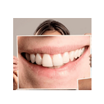 Best Dental clinic in Jhansi