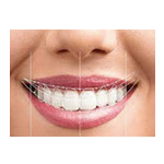 Best Dental clinic in Jhansi