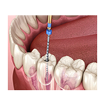 Best Dental clinic in Jhansi